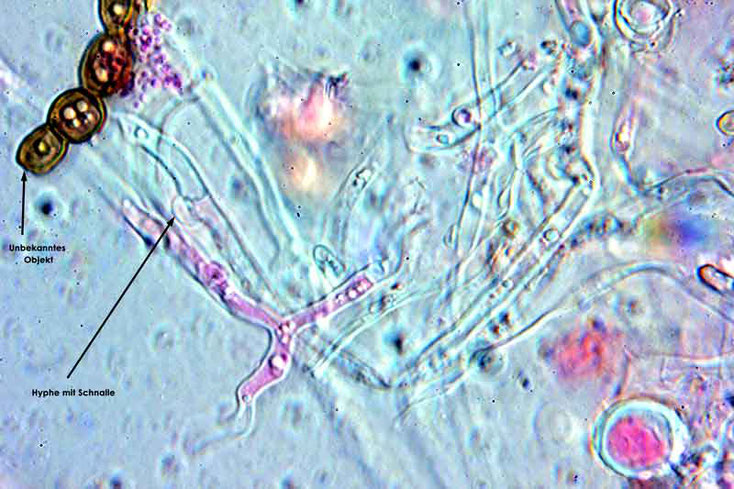 Bild 9 Hyphen mit Schnallen von Cylindrobasidium evolens, Objektiv Neofluar 100Öl, Vergrößerung 1000fach,