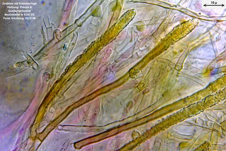 Bild 5 Zystiden von Amilosterium areolatum;  mit 1000facher Vergrößerung