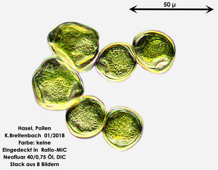 Bild 3 Hasel-Pollen ungefärbt in Ratio-MIC