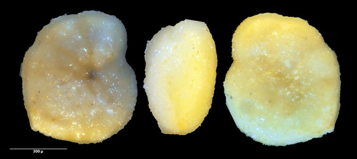 Bild 5 Foraminifere aus Aldeburgh, Suffolk UK, Gattung konnte nicht bestimmt werden. 