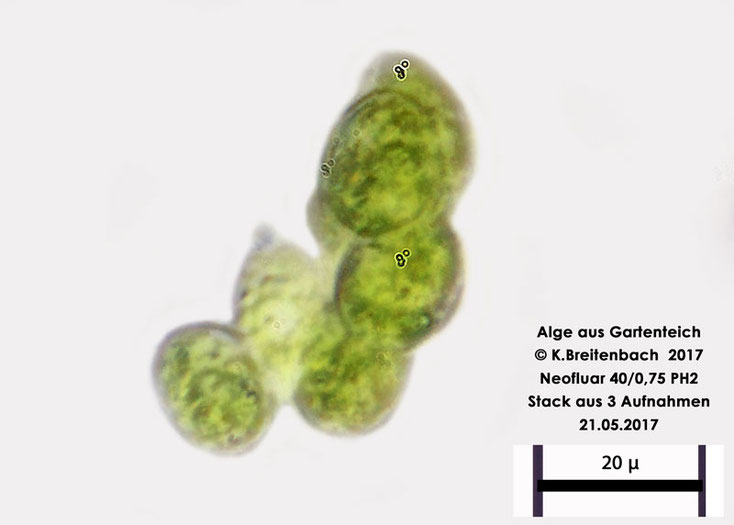 Bild 3 Algen aus unserem Gartenteich, vermutlich Colacium spec.