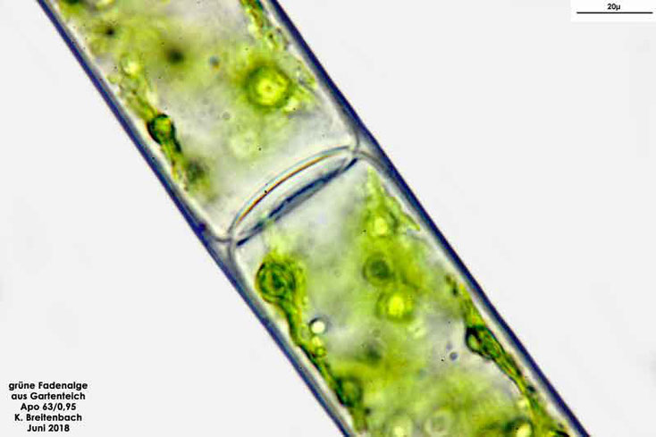 Jochalge. Gattung: Spirogyra sp. Vergrößerung 630 fach