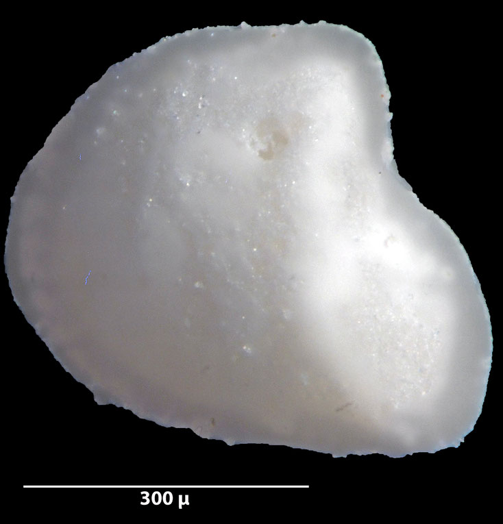 Foraminifere, Foraminifera, Bryozoa, Senckenberg, fossil, Stevns Klint, Dänemark, Maastrichtium