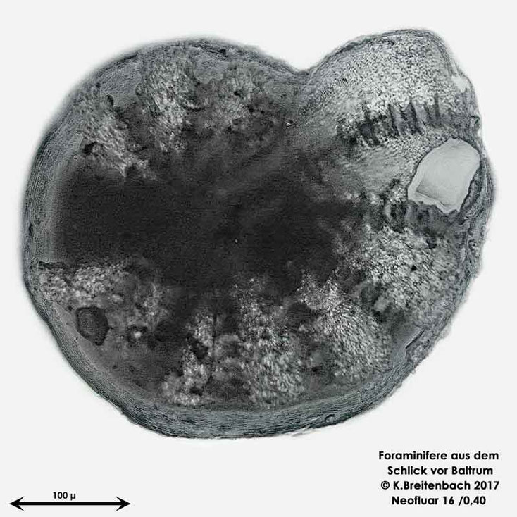 Bild 11 Foraminifere aus dem Wattschlick vor Baltrum; Art: Elphidium williamsoni Haynes 1973