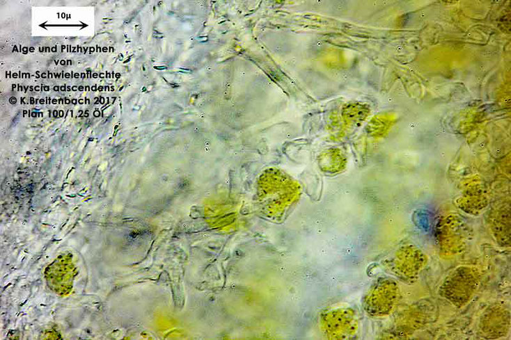 Bild 8 Flechte von Baumrinde, von einer Platane Alge und Pilzhyphen der Art: vermutlich Physcia adscendens (Helm-Schwielenflechte)