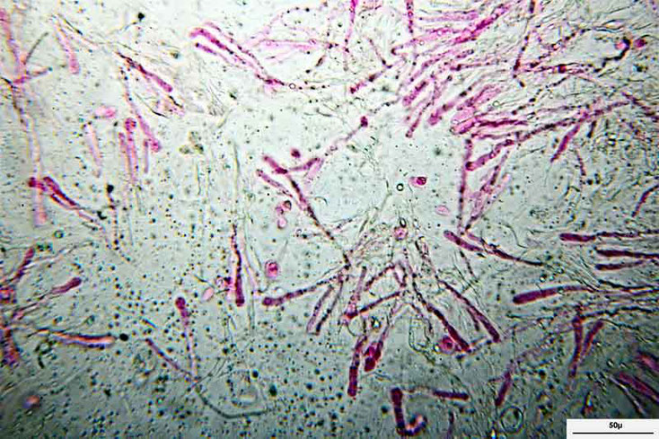 Bild 3 Zystiden und Basidiolen von Cylindrobasidium evolens, Objektiv Neofluar 40, Vergrößerung 400fach, Stack aus 20 Bildern