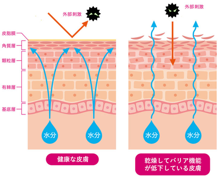 乾燥肌,肌荒れ