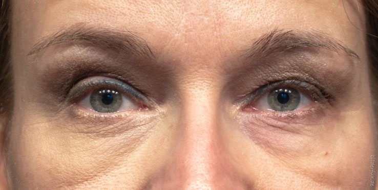 linke Bildseit mit Concealer, rechts ohne