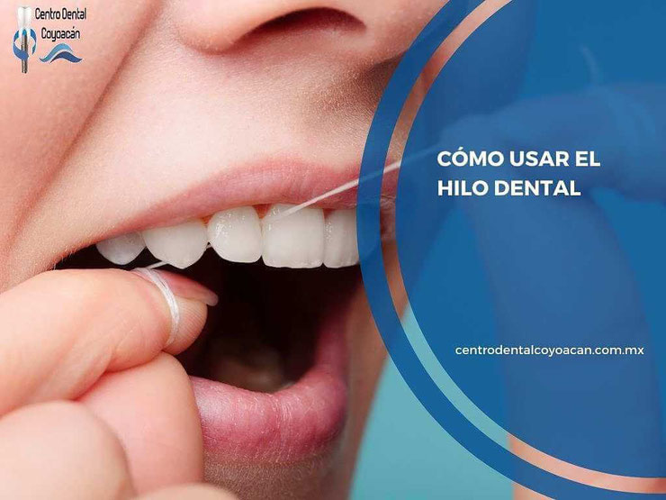 como usar el hilo dental - dentista en coyoacán - clínica dental en coyoacán