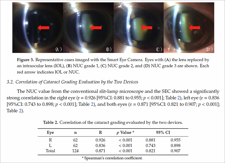 「Diagnostics」に掲載された白内障診断の有用性エビデンスに関する論文