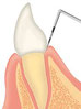 五反田　歯科　たかす歯科クリニック歯周検査
