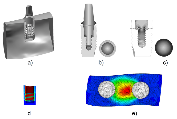 Overall view of implant and abutment inserted in the lower jaw region (a). Finite element analysis of implant-abutment interaction (b,c). Finite element analysis of press fit condition (d) and misfit condition of a two-implant frame (e)