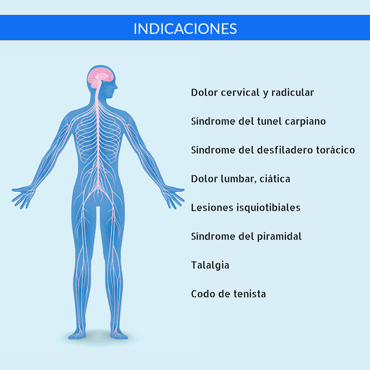 Indicaciones: epicondilitis, talalgia, tunel carpiano, piramidal, isquiotibiales, ciatica 