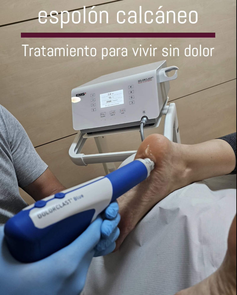 Paciente en Clínica San Javier recibiendo tratamiento con ondas de choque en espolón calcáneo
