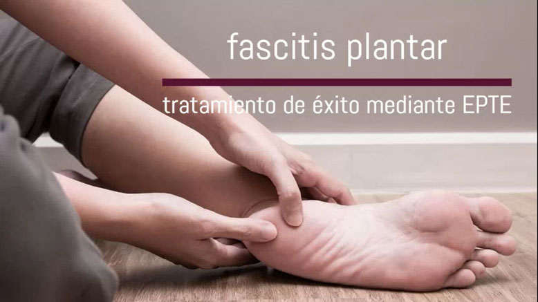 fascitis plantar madrid