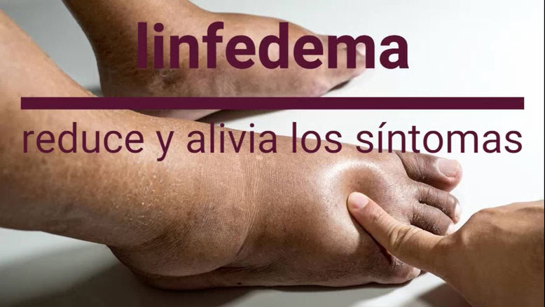 tratamiento linfedema Madrid