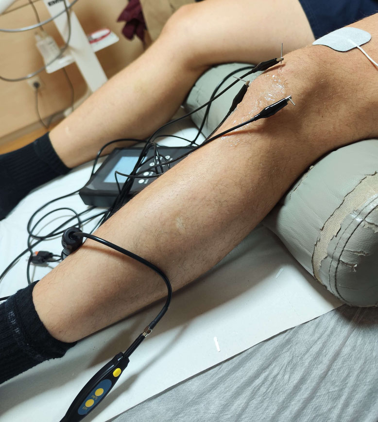 Tratamiento EPI en Clínica San Javier