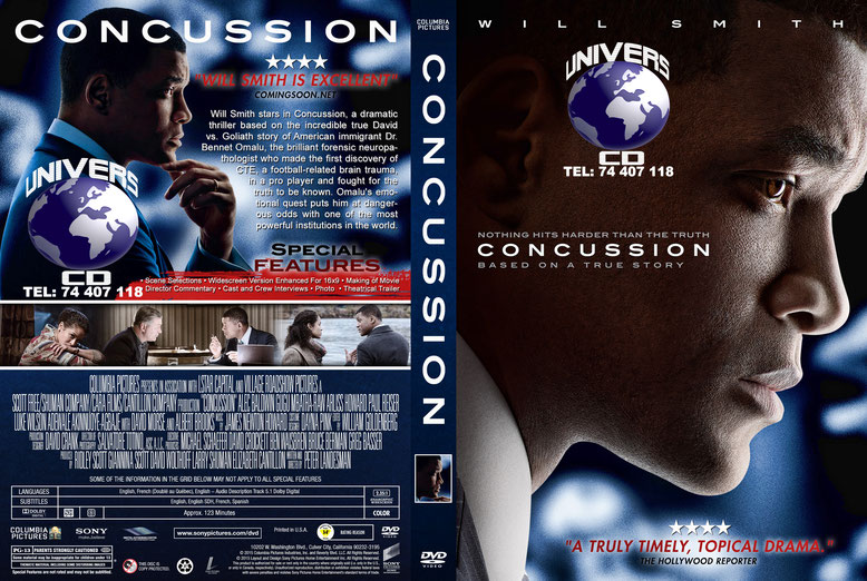 Concussion