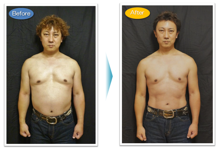 松戸市　新松戸　ポプラはりきゅう整骨院　ＡＣ耳つぼダイエット　ダイエット　松戸　南流山　流山市　柏市