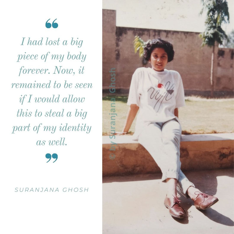 "Would I allow myself to be defined by my limb loss?" Suranjana at 18, a few months before being diagnosed with Osteosarcoma. (picture courtesy of Suranjana Ghosh)