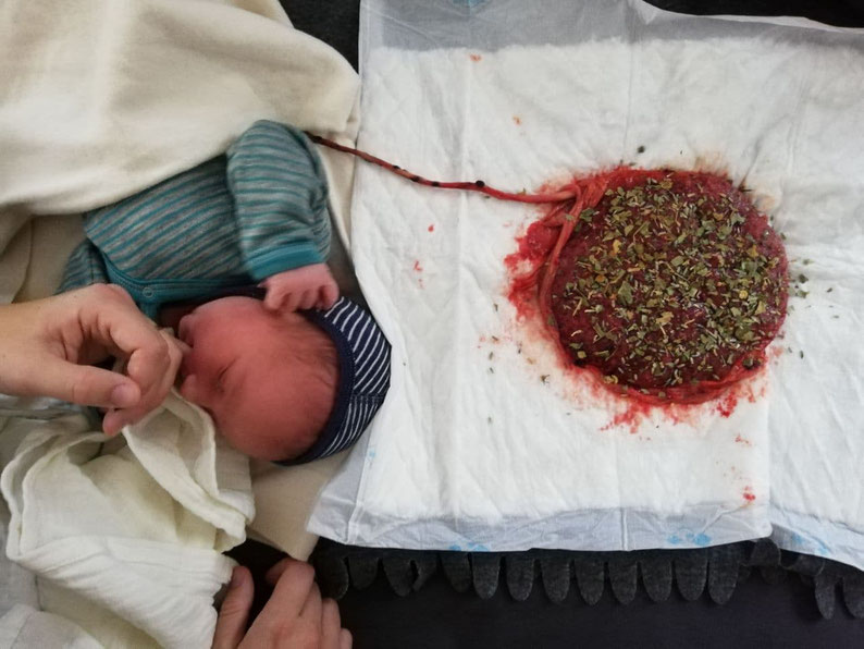 Baby and placenta at a lotus birth. In the picture above you see the placenta draining in a sieve, in the lower picture it has been treated with salt and herbs. (Both pictures by Luise)