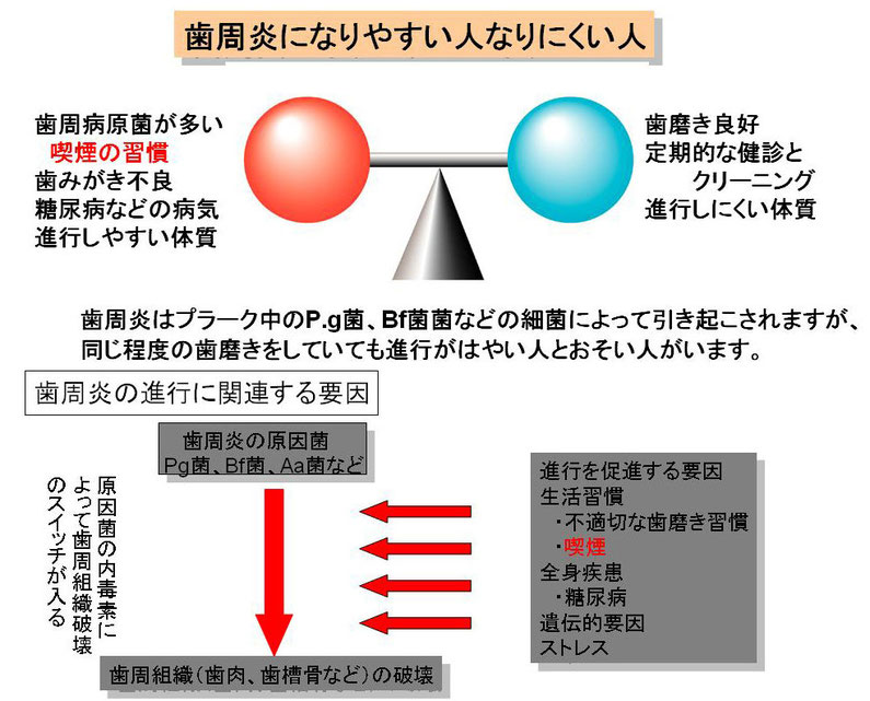 歯周炎のなりやすさ