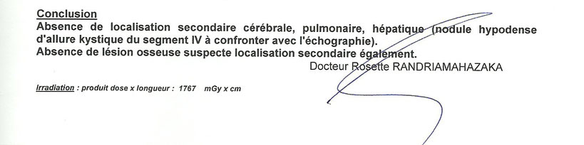 sievert en 2 lettres