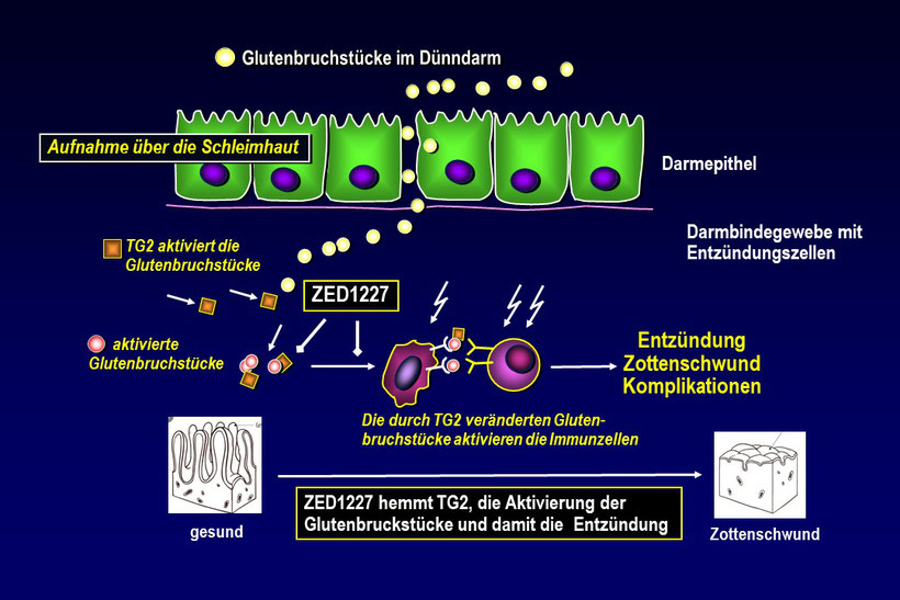 Bildunterschrift: Das neue Zöliakie-Medikament ZED1227 hemmt die überschießende Aktivität des Enzyms TG2 in der Dünndarmschleimhaut und unterbindet so die durch Gluten herbeigeführte Entzündung. Bildquelle: © Schuppan D. / Universitätsmedizin Mainz