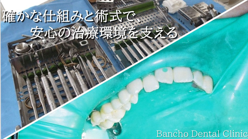 感染対策を確実に行うためのIMSの仕組み（左上）とラバーダム防湿術（右下）