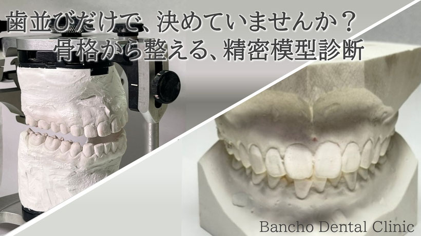 半調節性咬合器に付けた模型（左上）、並行模型（右下）
