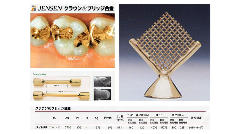優れた物性を持つ最高のゴールド修復材