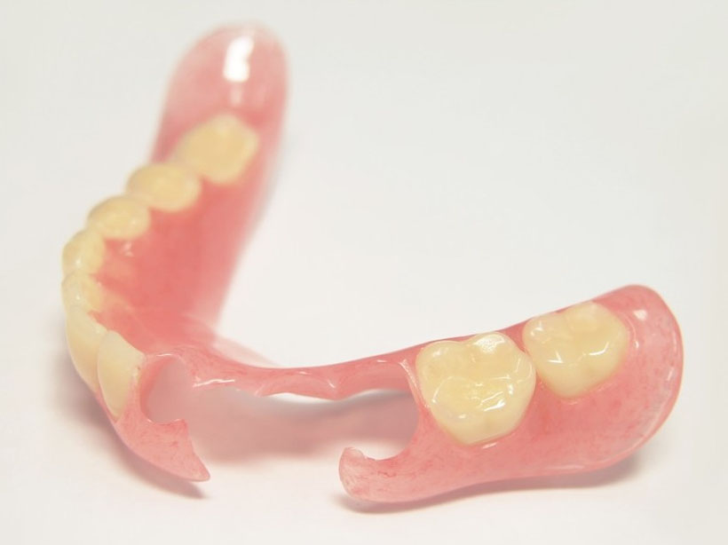 ノンクラスプデンチャーの写真。左下の2345番目のは無い