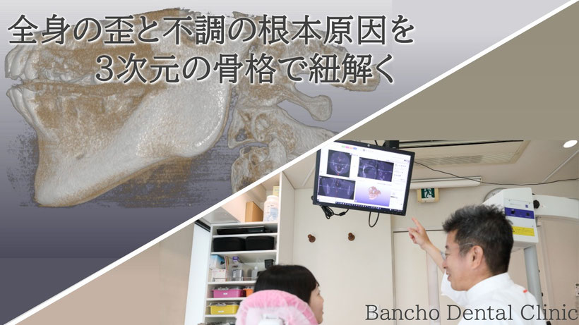 当院では、単に歯並びを綺麗にするだけの矯正ではなく、3次元CTを活用した骨格分析によって「顎（アゴ）のズレ」や「全身の不調の根本原因」を正確に読み解く精密矯正を行っています。では、なぜ従来の一般的な矯正診断では不調まで治すことが難しかったのでしょうか。まずは、これまで広く使われてきた「2次元レントゲン（セファロ）分析」に潜む、大きな落とし穴からお話しします。