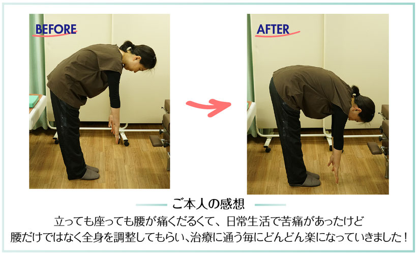 腰Before→After/本人の感想