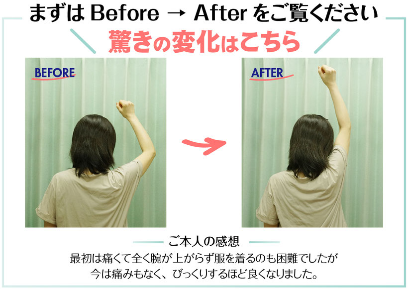 肩Before→After/本人の感想