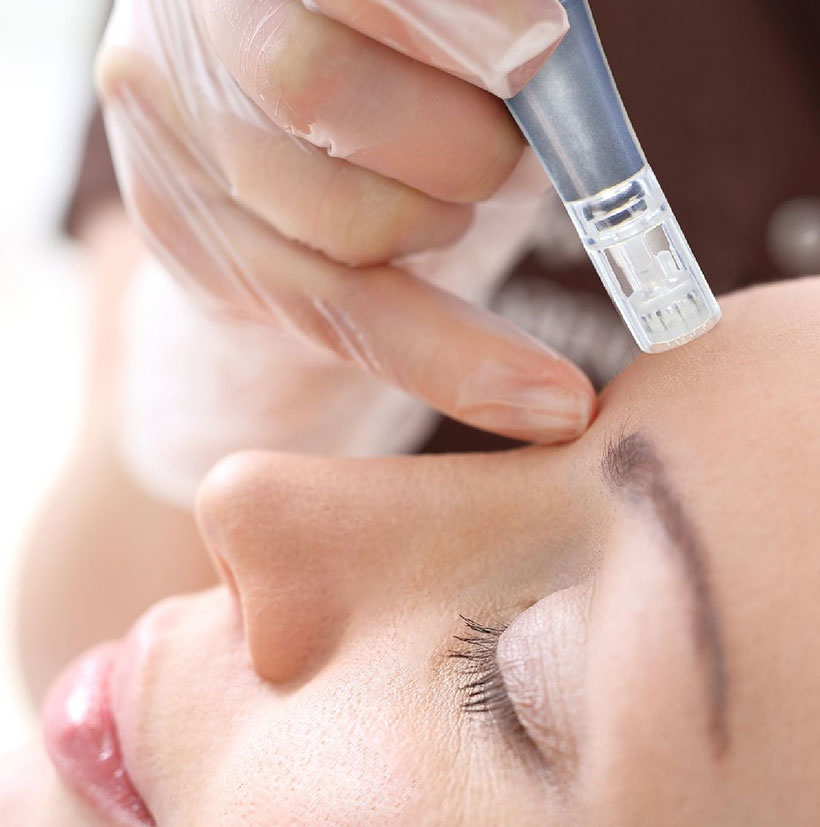 Dauerhafte Haarentfernung Diodenlaser IPL SHR Waxing Sugaring Hürth Kerpen Frechen Brühl Erftstadt