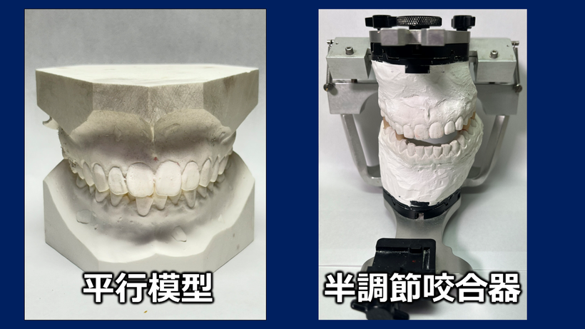 左はよく見かける並行模型、右は骨格と口の状態を正確に示した半t尿説咬合器による模型