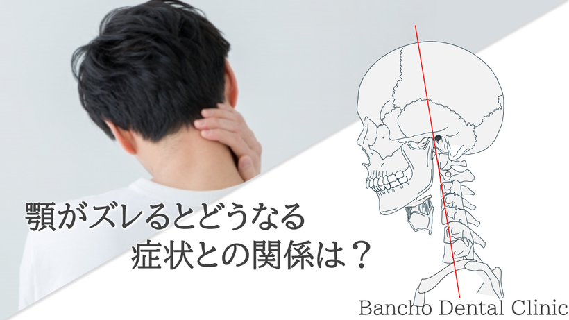顎が後ろにズレると骨格が変化します（右下）その結果首コリが起こります（左上）