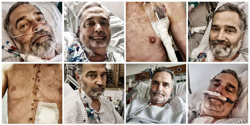 Herztransplantation