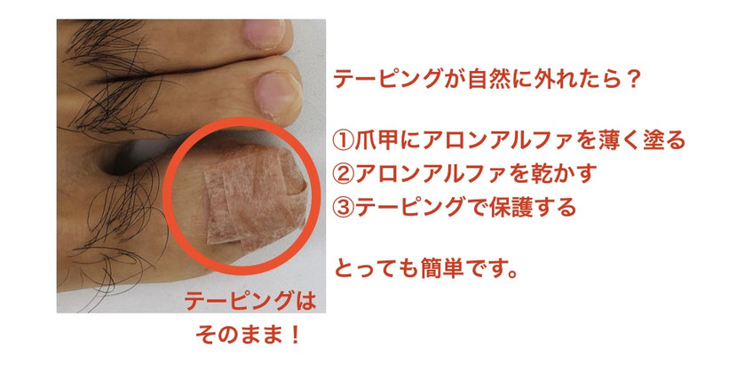 ワイヤー保護をするテープの貼り方