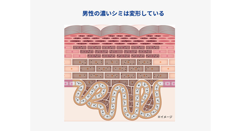 男性のシミの構造(小林製薬Webサイトより)