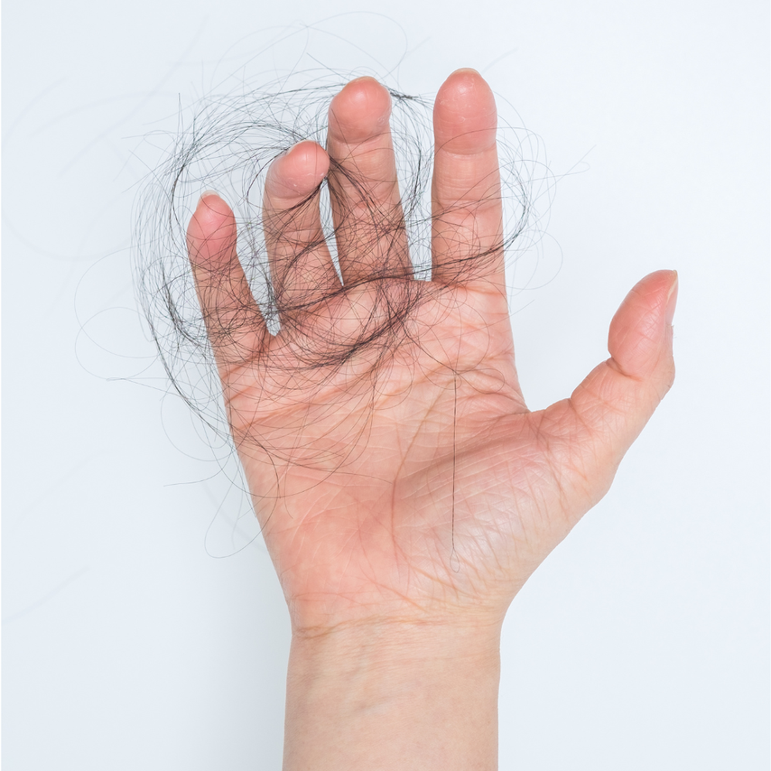 Haarausfall, yelasai, Haarausfallexperte nrw, Haarausfall Ursachen, Haarausfall natürlich behandeln, Haarausfallexperte Nrw, Friseur Haarausfall, Haarausfall Therapie, Haarausfall was tun, Haare werden dünner, Haarausfall Experten, Haarwuchsspezialist,