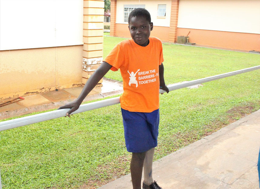 Jimmy is happy with his new prosthesis, allowing him to finally play with his friends again (picture courtesy of CoRSU)