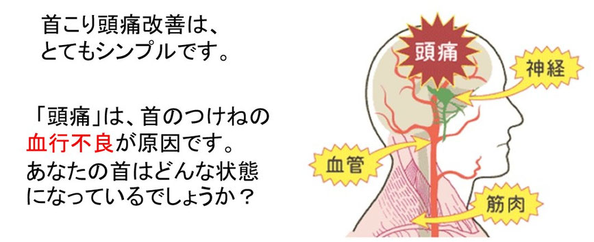 首こり頭痛改善の仕組みを説明する図解。「頭痛の原因は首のつけねの血行不良」という解説、人間の頭部と首の血管、神経、筋肉、頭痛の発生箇所を示したイラストが描かれています。