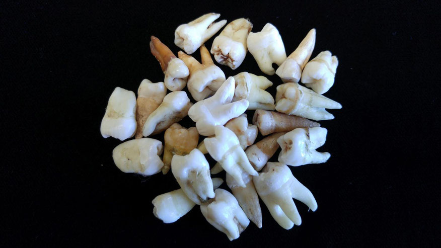 These are teeth from Megan Brickley’s lab at McMaster University. Credit McMaster University.