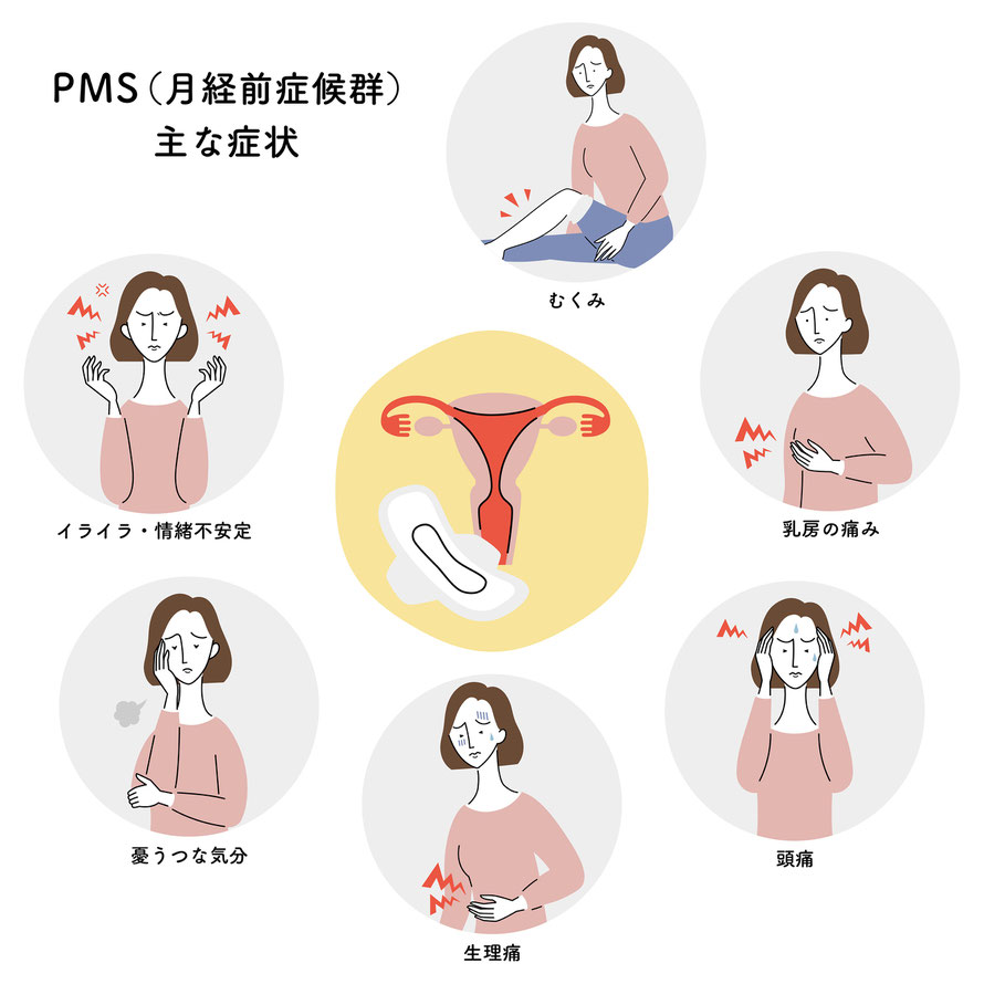 PMS（月経前症候群）主な症状・むくみ・乳房の痛み・イライラ・情緒不安定・頭痛・憂うつな気分・生理痛