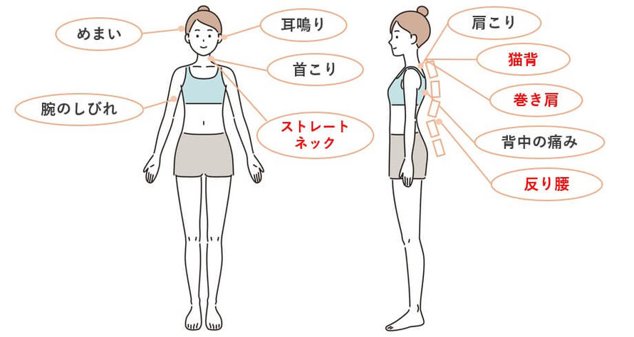 めまい、耳鳴り、腕のしびれ、ストレートネック、姿勢改善など改善する症状が詳しく書かれている図