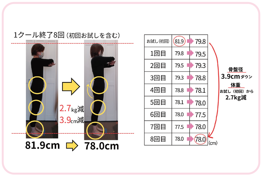 キラキラ期骨盤調整　ビフォーアフター写真