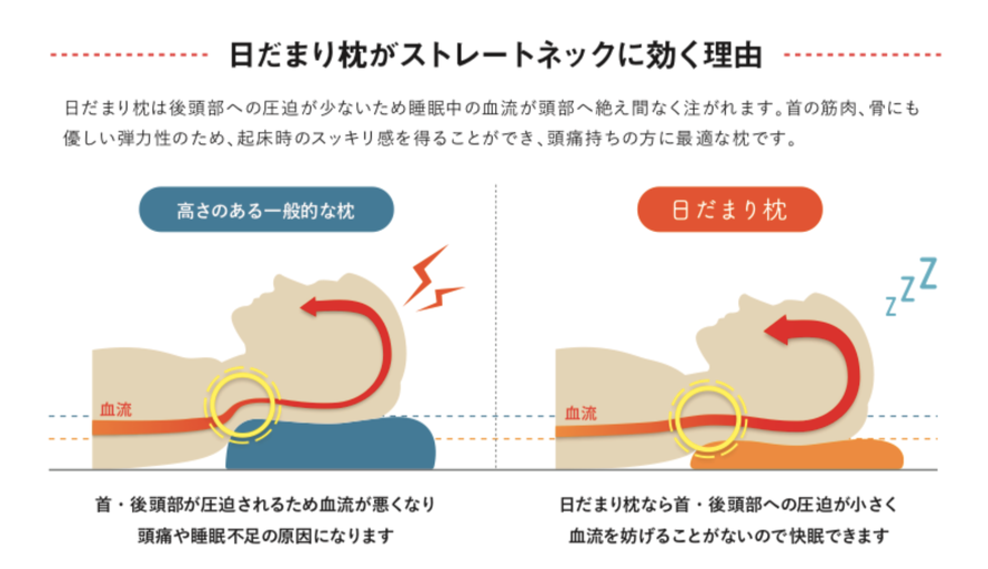 日だまり枕がストレートネックに効く理由。首・後頭部への圧迫が小さく、血流を妨げることがないので快眠できます。