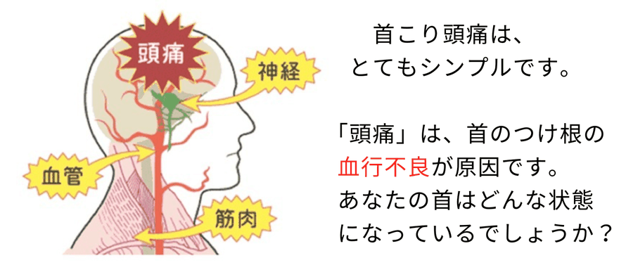 首が疲れる、後頭部がいつも痛くてつらすぎる頭痛　血行不良が原因